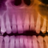 Minimalinvasive operative Verfahren – möglich durch 3D-Diagnostik