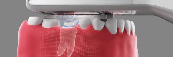 Ultraschall als Diagnosewerkzeug – das ist unsere Vision