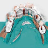 Oralchirurgie 2.0 | Interview mit Sebastian Beisel