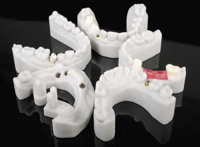 Was für Schrauber: Shera4implants - Digital Dental Magazin