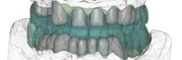 Der digitale Workflow im Dentallabor – State of the Art – Episode II