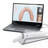 iTero Intraoralscanner. Komplett digitaler Workflow für präventive und restaurative Zahnmedizin.