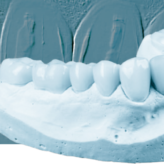 Vollständiger digitaler Workflow mit integriertem Dentalscan und nanokeramischer Hybrid-CAD/CAM-Disc