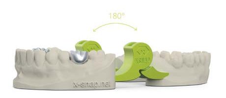 „Kleines Gelenk mit großer Wirkung“. xSNAP integriert 3D-Artikulator ins Kunststoffmodell