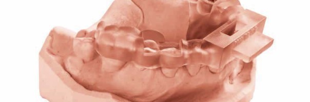 Additive Technologien in der Zahnmedizin und moderne 3D-Drucker in der Übersicht