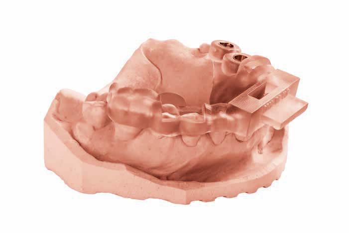 Additive Technologien in der Zahnmedizin und moderne 3D-Drucker in der Übersicht