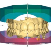 CEREC Orthosoftware – Die Kieferorthopädie wird digital