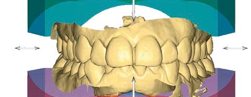 CEREC Orthosoftware – Die Kieferorthopädie wird digital