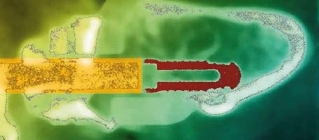 Computernavigierte Implantation und 3D-Knochenblockaugmentation