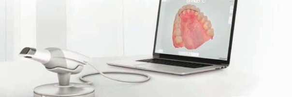 Dental Direkt schließt Vertriebskooperation mit 3Shape