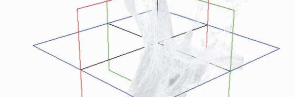 Die postendodontische Erkrankung und die Bedeutung der DVT für die Diagnose