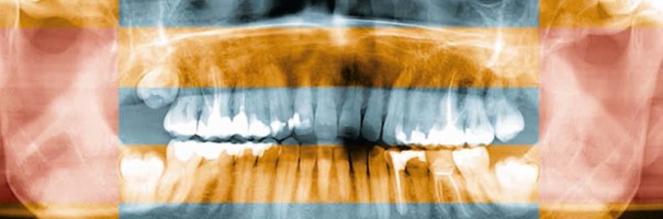 Die radiologische Darstellung des Kiefergelenks