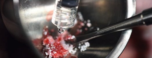 Hyaluron und patientenindividuelle Titangitter im Konzept der komplexen Kieferkammaugmentation