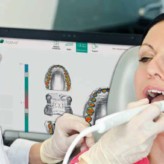 Intraorale Scansysteme: Win-win für Praxis, Labor und Patienten