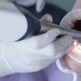 Marktübersicht Intraoralscanner