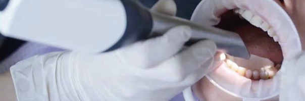 Marktübersicht Intraoralscanner