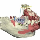 Über Fotografie, Digital Smile Design und 3-D-Visualisierung zur endgültigen Versorgung