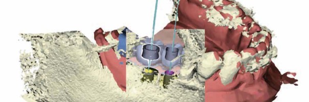 Über Fotografie, Digital Smile Design und 3-D-Visualisierung zur endgültigen Versorgung